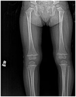 Birth Trauma Cases