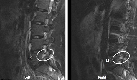 Pediatric Spinal Conditions